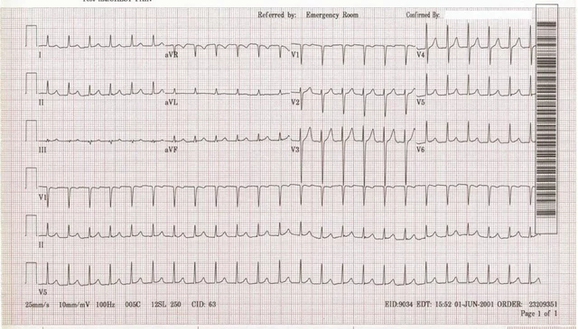 The Importance of Regular Check-ups for Supraventricular Tachycardia Patients