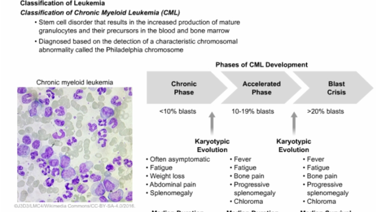 The Impact of Chromosome-Positive Lymphoblastic Leukemia on Fertility and Pregnancy