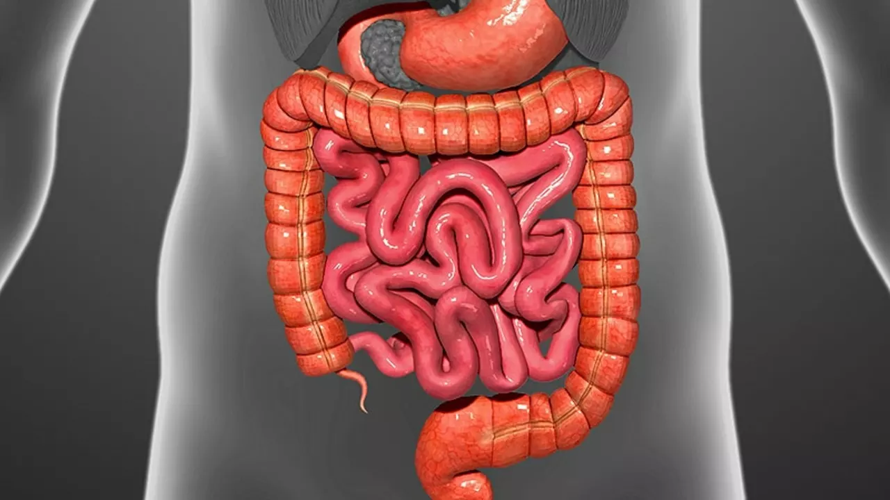The Link Between Functional Dyspepsia and Irritable Bowel Syndrome